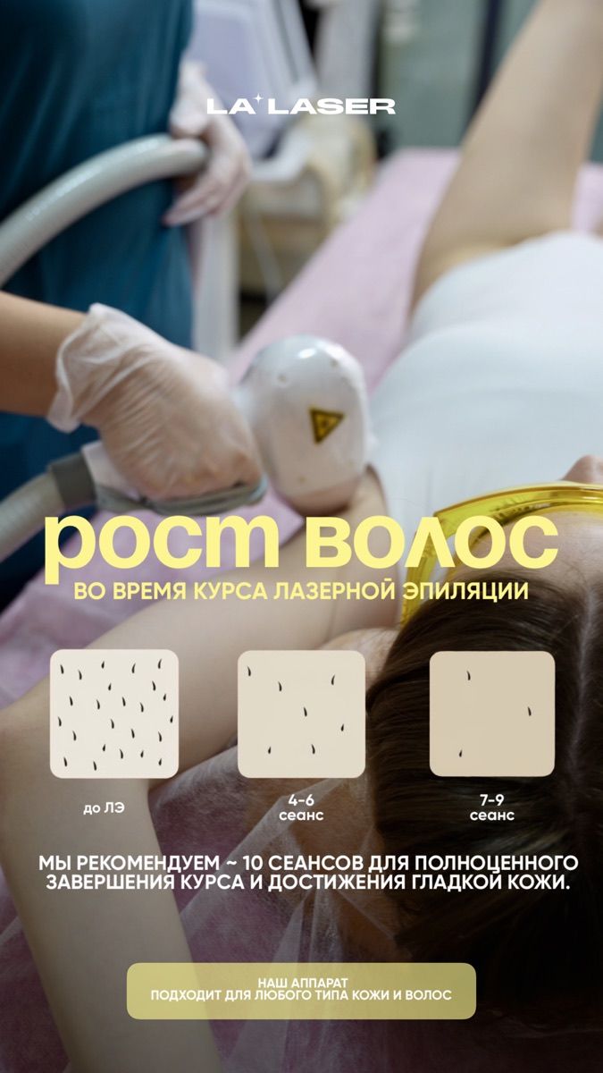 Рост волос во время курса лазерной эпиляции